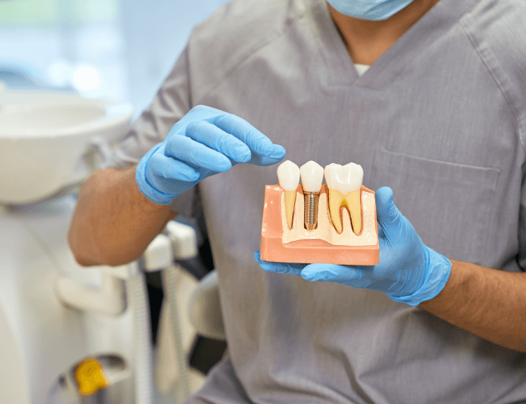 Kostengünstige Zahnimplantate in Usak