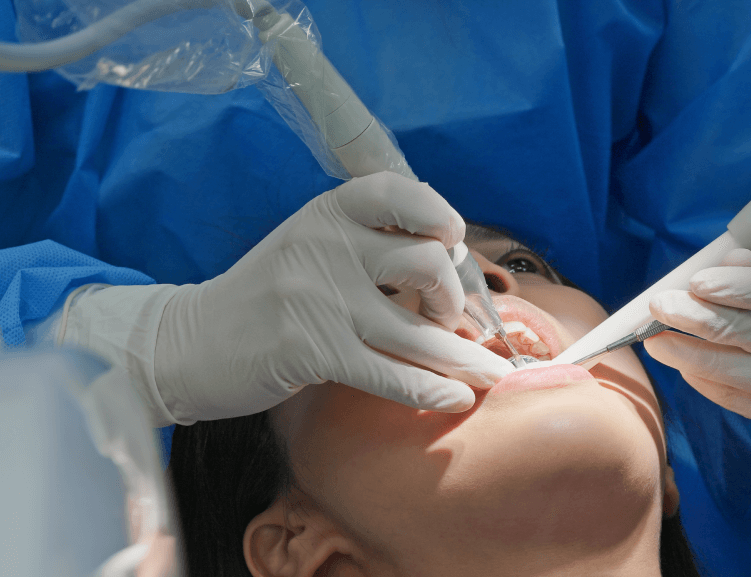 Kostengünstige Wurzelkanalbehandlung in Usak