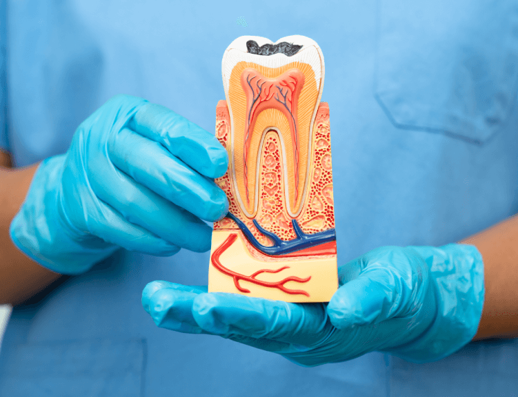 Vorteile einer Wurzelkanalbehandlung in Usak