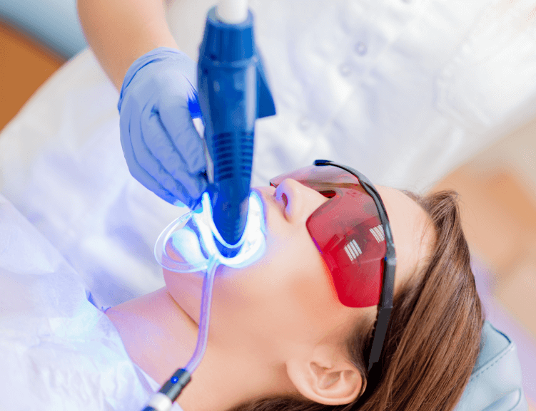 Erschwingliche Zahnaufhellung in Usak