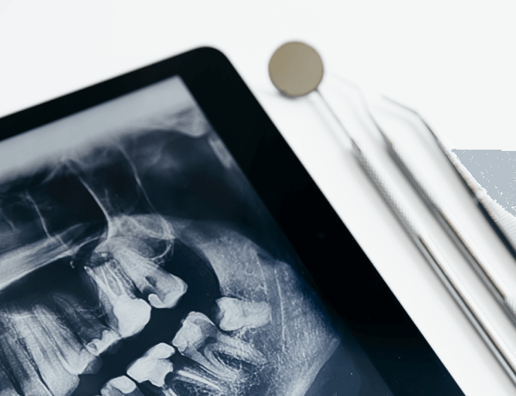 Vertrauenswürdige Kieferchirurgie in Usak