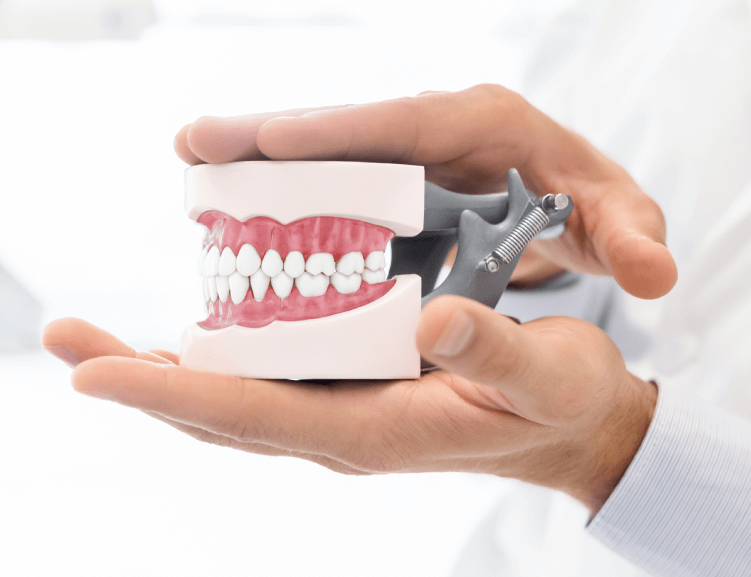 Kieferchirurgie durch Experten