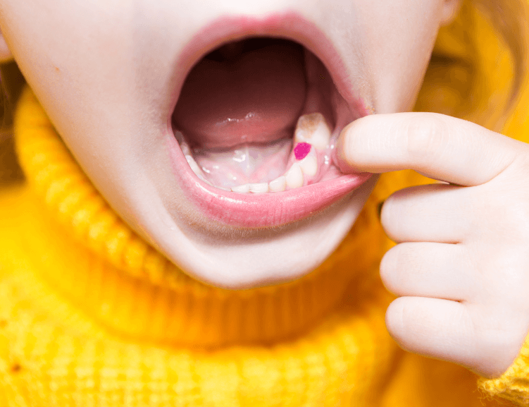 Kinderzahnheilkunde von Experten