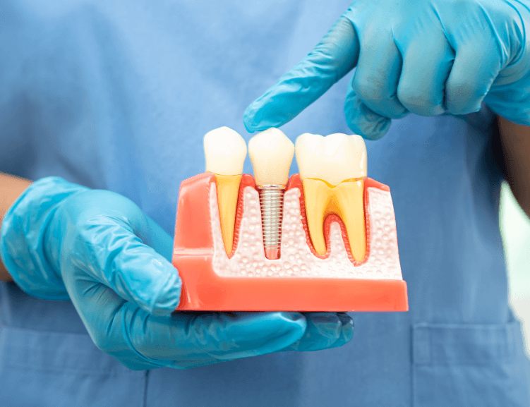 Vorteile der Behandlung von Zahnfleischerkrankungen