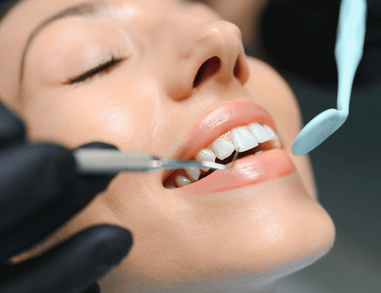 Fortschrittliche Laminat-Zahn-Techniken